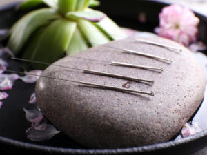 Soins traditionnels - acupuncture - les Soins Zen
